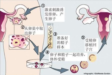 男性因素案例